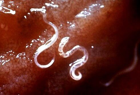 vücuttaki parazitler