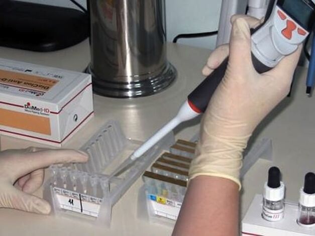 Paraziter hastalıkları teşhis etmek için laboratuvar testleri